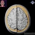 Cross section of head - level 2